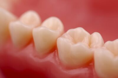 Стоматолог Рэймидж рассказала, как определить диабет по зубам и деснам